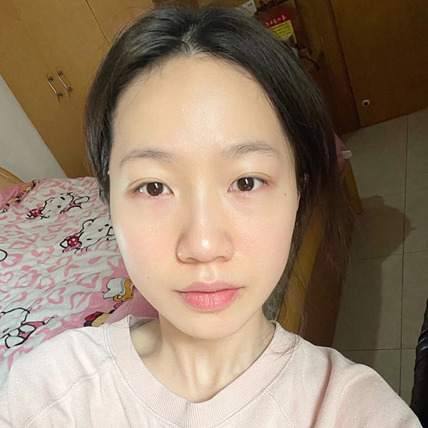 運動後肌膚乾燥泛紅？敏感肌必推-療癒小藍瓶「ATLA肌密青春原液」