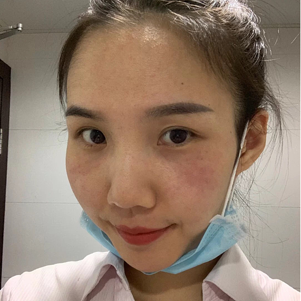皮膚泛過敏保養推薦