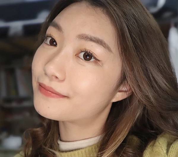 消痘疤、下巴痘、額頭痘、生理痘保養對比