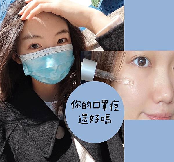 口罩痘、消痘疤、下巴痘、人中痘、額頭痘、生理痘，最有感消痘經驗分享-ATLA肌密能量水