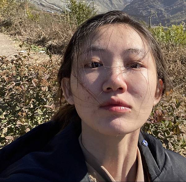口罩痘、消痘疤、下巴痘、人中痘、額頭痘、生理痘，最有感消痘經驗分享-ATLA肌密能量水