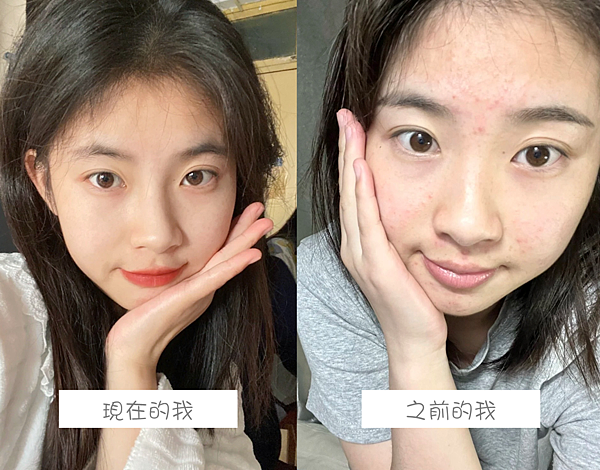 擦的淨膚ATLA肌密能量水評價