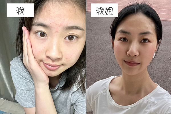 擦的淨膚ATLA肌密能量水評價