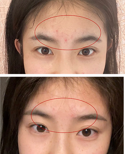 擦的淨膚ATLA肌密能量水評價