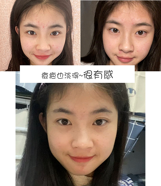 擦的淨膚ATLA肌密能量水評價