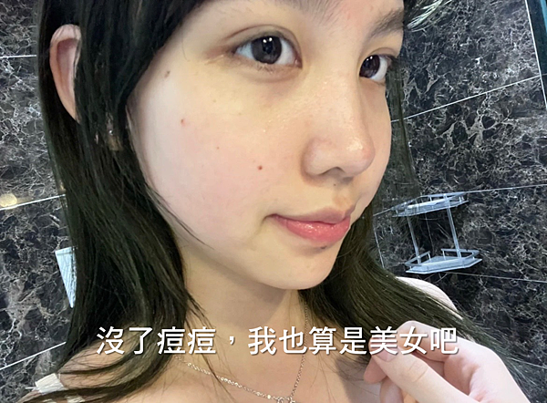 毛孔粗大、消痘疤、T字出油、下巴痘、人中痘、額頭痘保養