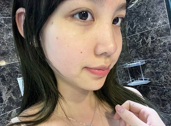 快速消痘疤,擦的淨膚ATLA肌密能量水評價 毛孔粗大、消痘疤、T字出油、下巴痘、人中痘、額頭痘保養