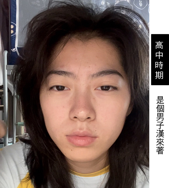 告別痘痘肌！告別毛孔粗大！油臉人如何保養？不藏私愛用品分享