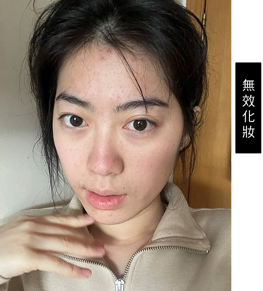 告別痘痘肌！告別毛孔粗大！油臉人如何保養？不藏私愛用品分享