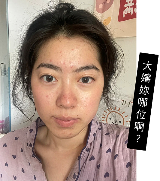 告別痘痘肌！告別毛孔粗大！油臉人如何保養？不藏私愛用品分享