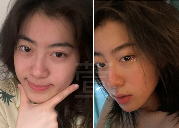 告別痘痘肌！告別毛孔粗大！油臉人如何保養？不藏私愛用品分享