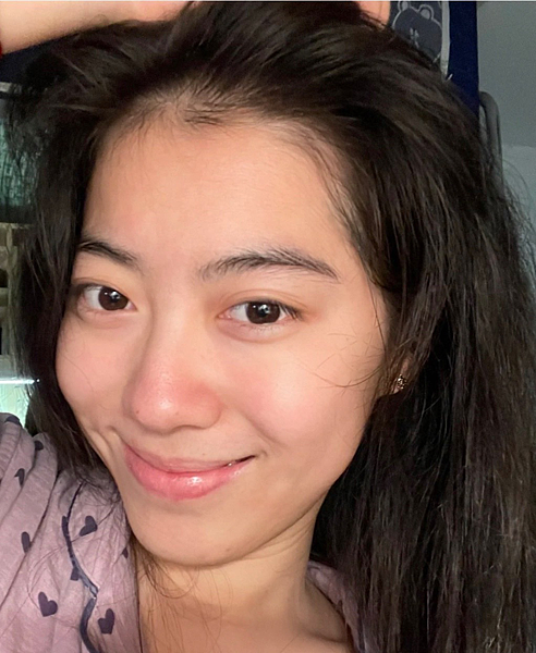 告別痘痘肌！告別毛孔粗大！油臉人如何保養？不藏私愛用品分享