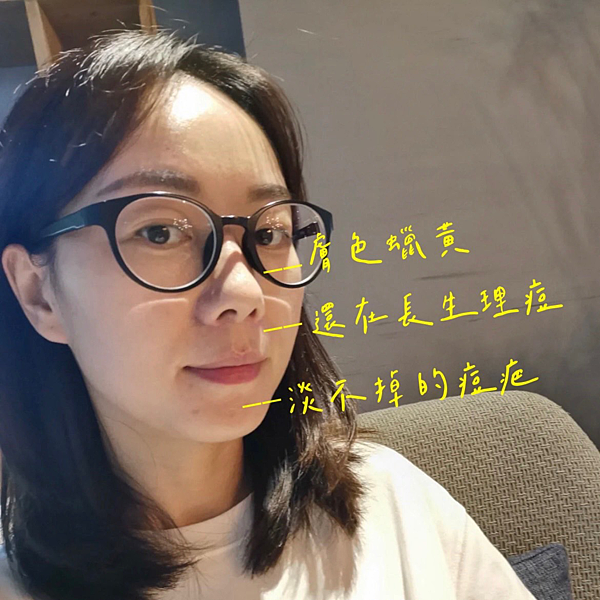 40歲美白推薦、蠟黃、生理痘、痘疤、下巴痘