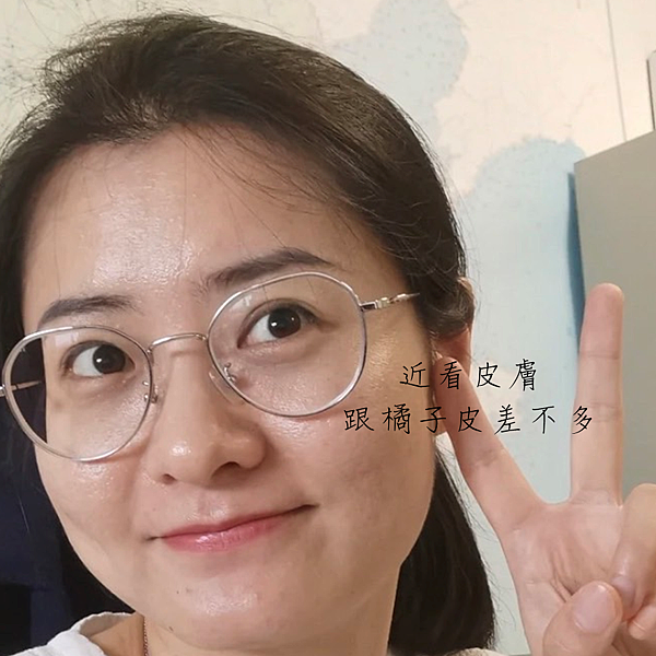 混合痘痘肌保養推薦，擦的淨膚-毛孔、痘疤凹洞、閉鎖痘、陳年痘疤、出油特別有感