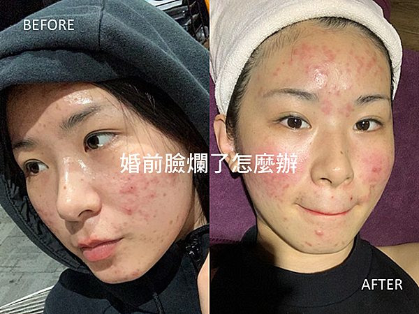 肌密能量水/肌密青春原液評價如何