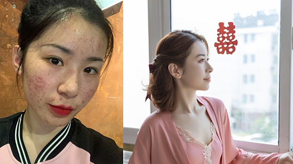 肌密能量水/肌密青春原液評價如何