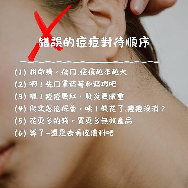 痘痘肌保養推薦 長痘痘常犯的錯誤做法