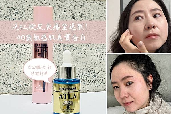 40歲敏感肌真實告白 40歲敏感肌保養推薦