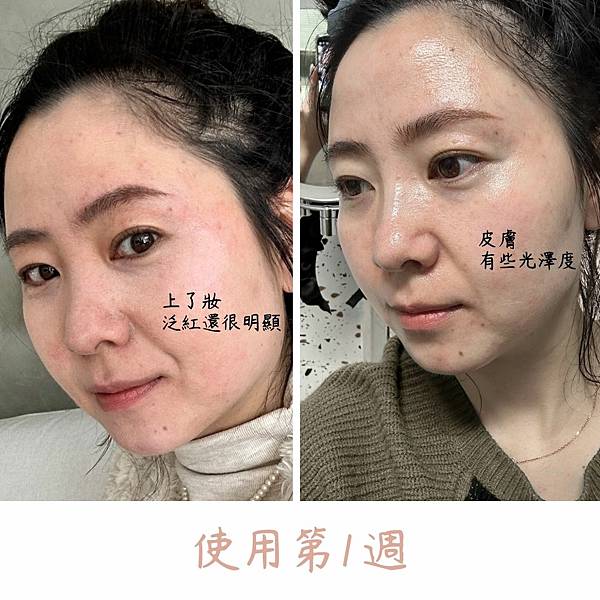 40歲敏感肌保養步驟 肌密青春液評價如何