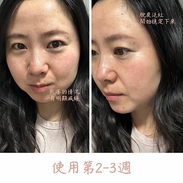 妳是誰啊 (2) 敏感肌修護對比