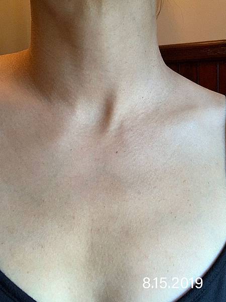 Neck0815.jpg