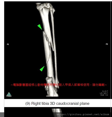 貓咪墜樓 下頷骨折固定手術 跟骨 脛骨骨折固定手術 虎兒的復健之路 二 路人甲 旅行筆記 生活筆記 痞客邦 貓咪墜樓 下頷骨折固定手術 跟骨 脛骨骨折固定手術 虎兒的復健之路 二 路人甲 旅行筆記 生活筆記 痞客邦