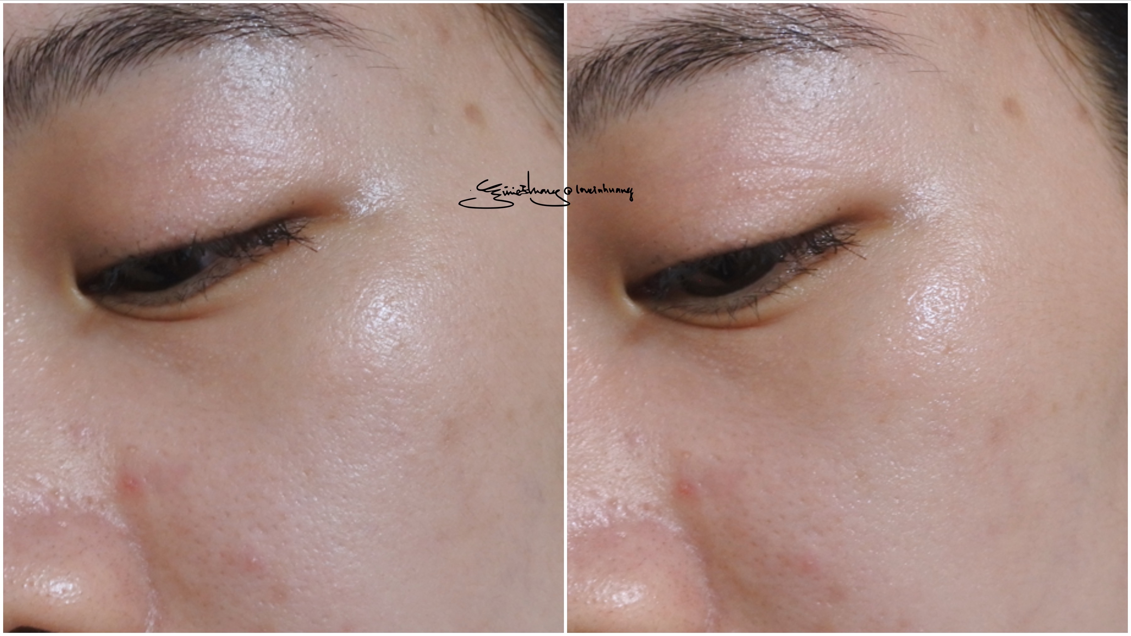 DERMEDIC 玻尿酸超水感保濕精華 DERMEDIC 玻尿酸超水感保濕精華