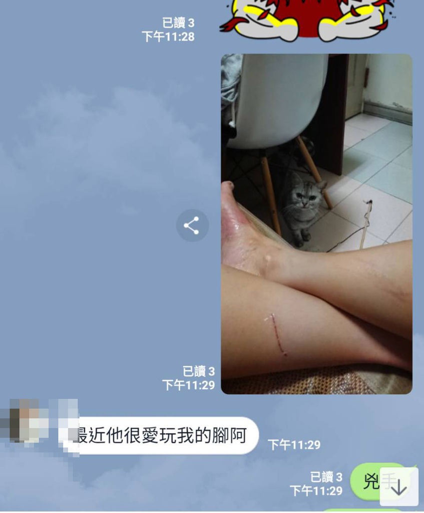 維妮舒除疤 維妮舒除疤