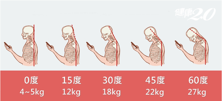 低頭族姿勢不良