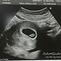 blog-pregnant-11.jpg