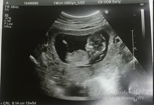 blog-pregnant-12.jpg