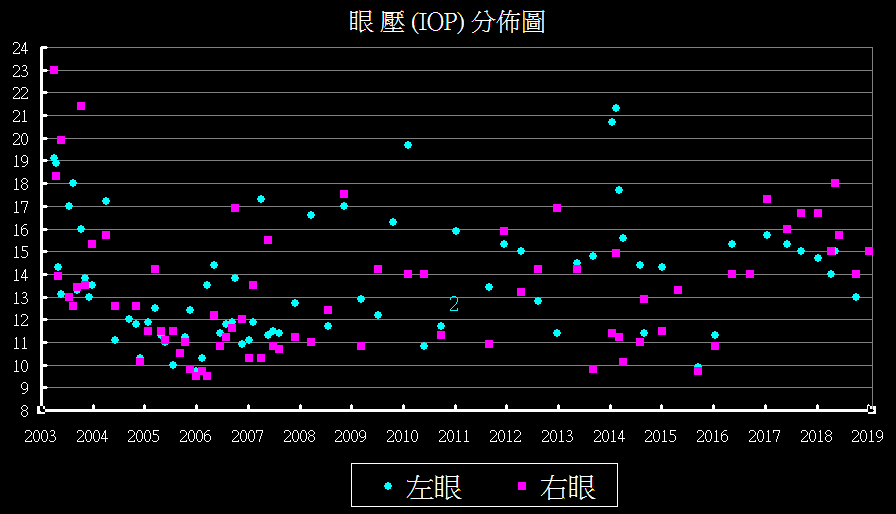 眼壓分佈圖.gif