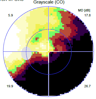 20190110grayL.gif