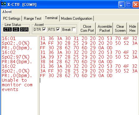 X-CTU(血氧資料).JPG