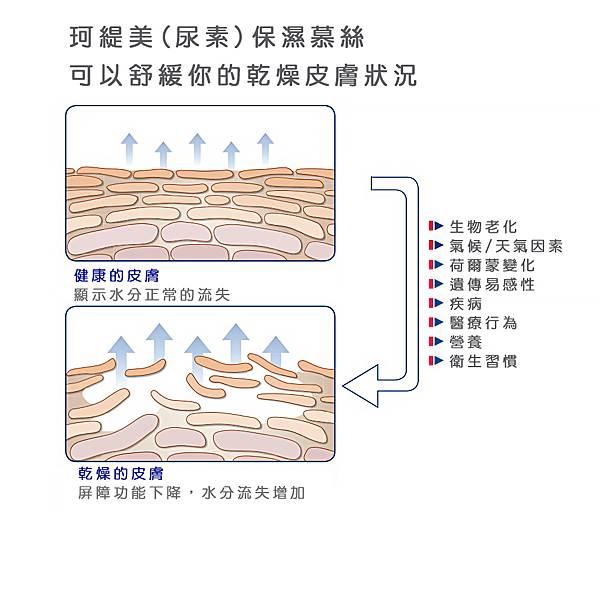 珂緹美潤膚慕絲Cutimed ACUTE 5%尿素 護手霜 