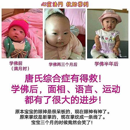 請勿放棄每一個唐氏綜合症的孩子 佛法改變了我孩子的容貌 觀世音菩薩心靈法門的部落格 痞客邦