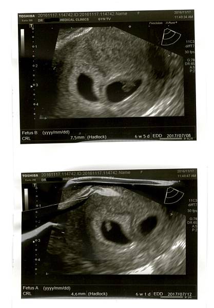 AB_17Nov2016.jpg AB_17Nov2016.jpg