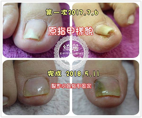 1完成前後比較.jpg 1完成前後比較.jpg