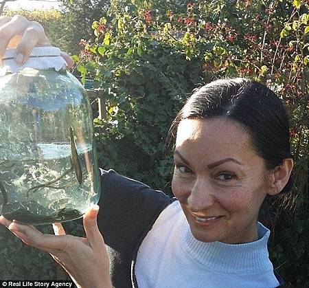 500隻水蛭進子宮治病？英45歲婦懷孕了