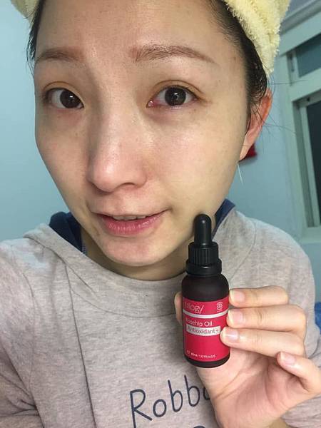 女人知己試用大隊,trilogy,紐西蘭天然有機品牌,trilogy逆齡抗老有機玫瑰果油,抗老,天然有機認證,玫瑰果油,保濕滋潤,天然萃取植物精華,淡化細紋,Rosapene專利抗老成分