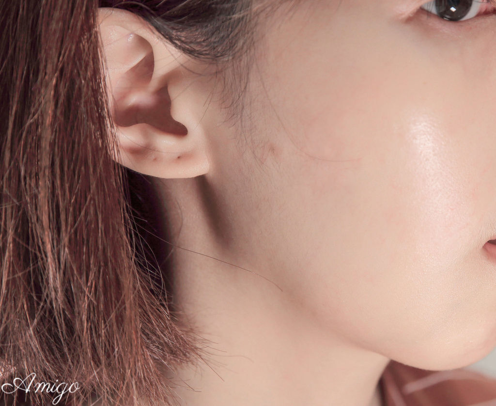 Acnes 抗菌痘痘貼