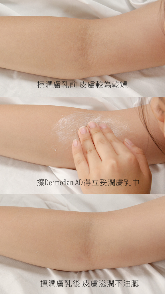 Dermoflan AD得立妥潤膚乳