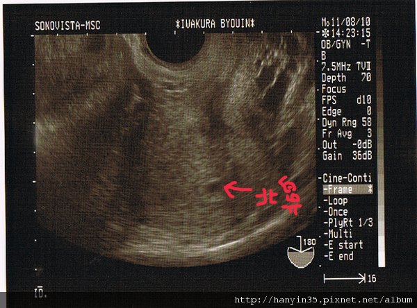 2010-11-1確定懷孕.jpg