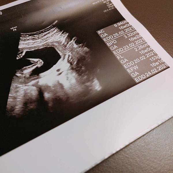 懷孕胎兒超音波照16週