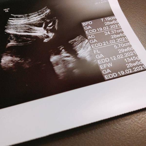 懷孕胎兒超音波照28週