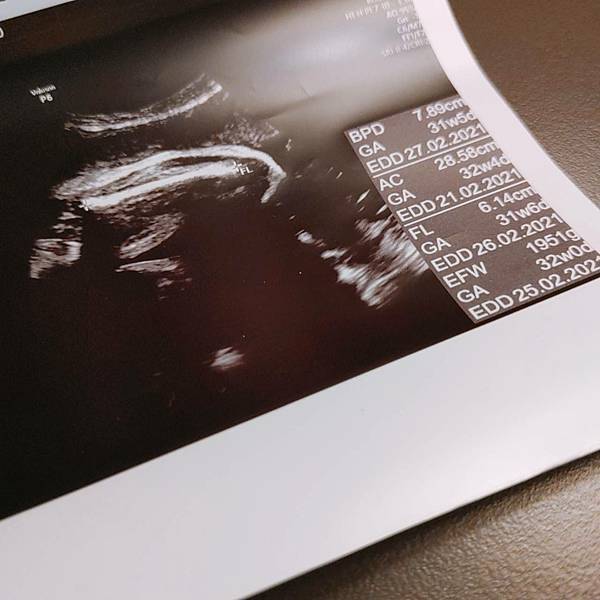 懷孕胎兒超音波照32週