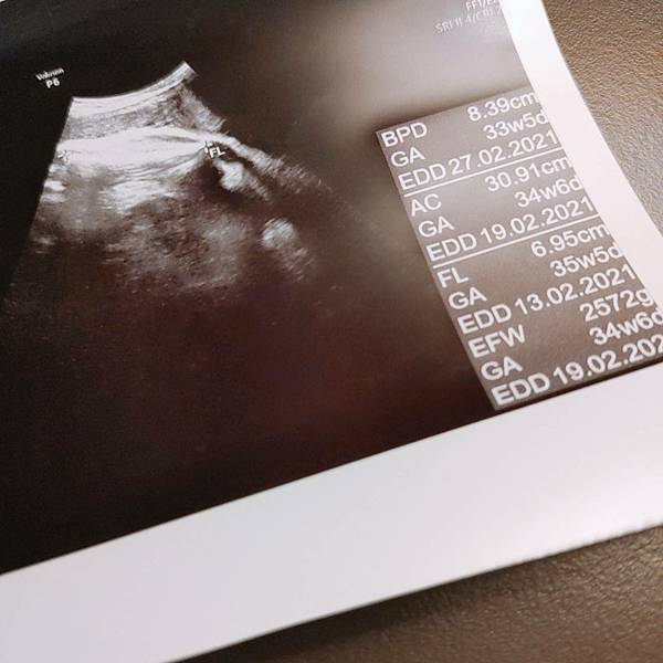 懷孕胎兒超音波照34週