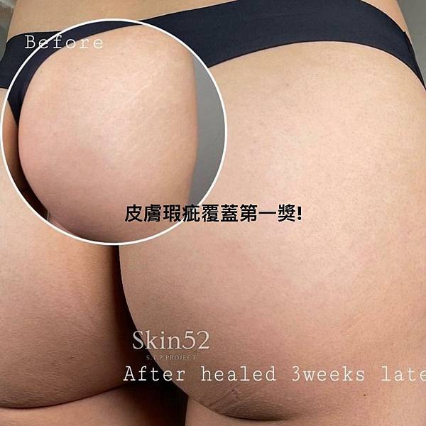 278868514_3063536850566156_6734450765986468851_n.jpg 278868514_3063536850566156_6734450765986468851_n.jpg