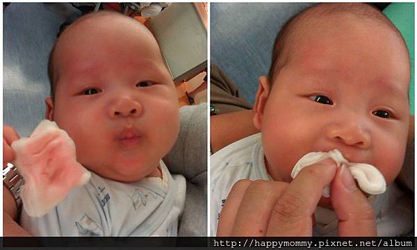 2014.05.20 剪舌繫帶 (4).jpg