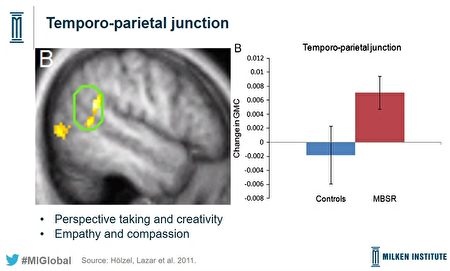 meditation-brain-benefit-02